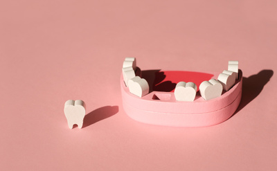 Средства для&nbsp;отбеливания зубов: советы стоматолога